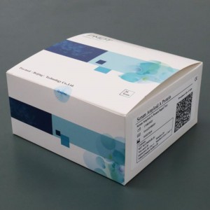 Serum Amyloid A Proteint  Rapid Test